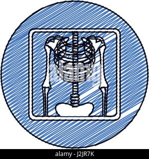 Disegno a matita colorata cornice circolare con radiografia del torace Illustrazione Vettoriale