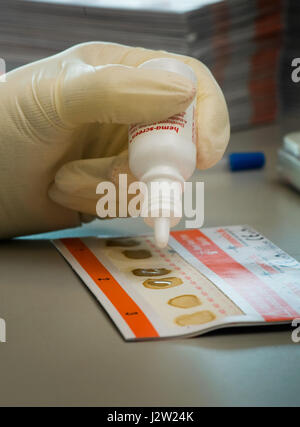 Test di campioni fecali su un intestino scheda di screening per la presenza di occulta (nascosta) sangue Foto Stock