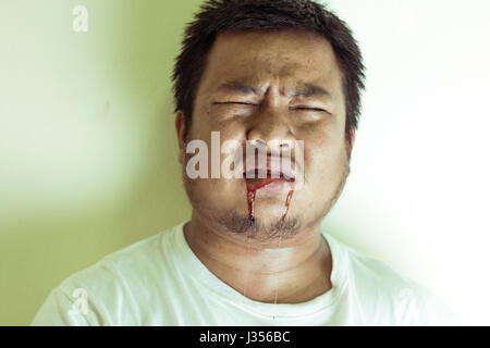 Ritratto di Asian giovane uomo sente dolore allora il sanguinamento dalla bocca. Foto Stock