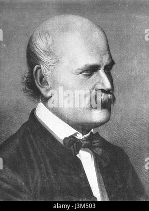 Ignaz Semmelweis 1860 Foto Stock