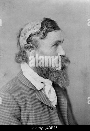 Robert McGee, scalped come un bambino dal Capo Sioux piccola tartaruga marina nel 1864 Foto Stock