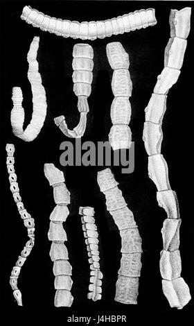 Tenia solium3 Foto Stock