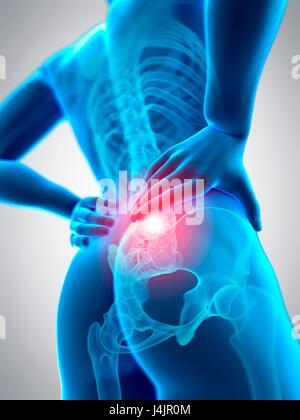 Colonna vertebrale umana e mal di schiena, illustrazione. Foto Stock