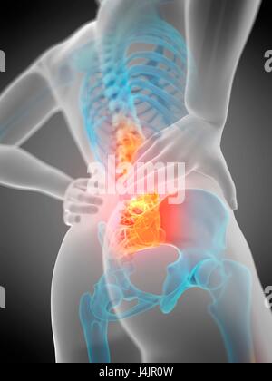 Colonna vertebrale umana e mal di schiena, illustrazione. Foto Stock