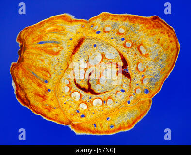 Vista microscopico di pino silvestre (Pinus sylvestris) cono sezione trasversale. Rheinberg illuminazione. Foto Stock