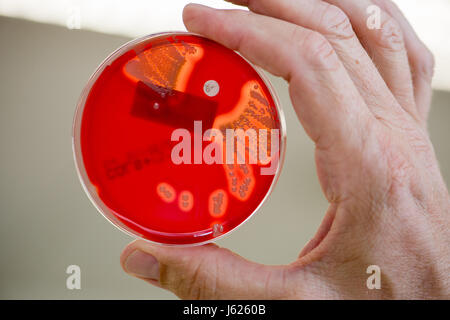 Regensburg, Germania. Decimo Apr, 2017. Immagine di una piastra di petri con colonie emolitica di Staphylococcus aureus prese presso la clinica universitaria di Regensburg, Germania, 10 aprile 2017. Schneider è la Baviera il primo professore di igiene ospedaliera. Presso la clinica dell'Università di Regensburg egli fornisce una formazione avanzata per i medici e il personale medico, consigli cliniche in Baviera orientale e ricerche organismi multiresistenti. Foto: Armin Weigel/dpa/Alamy Live News Foto Stock