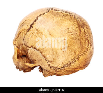 Un vecchio jawless Scull umana vista posteriore isolato su bianco Foto Stock