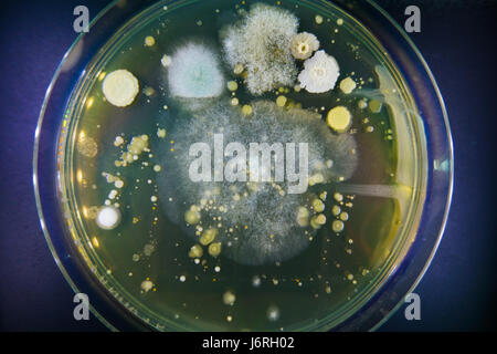 Capsule di Petri con la crescita della microflora. Studio locali igiene ristoranti. La sicurezza alimentare Foto Stock