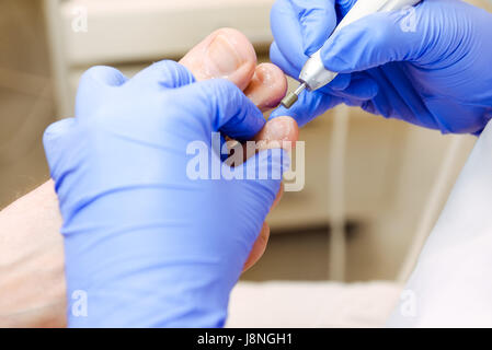 Master forme podologica i chiodi . Paziente di sesso maschile nel processo di hardware procedura di pedicure. Il concetto di cura del corpo. Close up, il fuoco selettivo Foto Stock