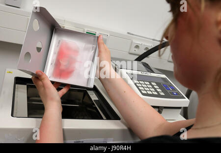 Rostock, Germania. 19 Maggio, 2017. Nadine Deuschle prepara pre-preparato il cuore umano valvole per il congelamento in azoto liquido a GTM-V a Rostock, Germania, 19 maggio 2017. Il GTM-V ha ottenuto - appena in tempo per la donazione di organi giorno il 03 giugno 2017 - un'autorizzazione per la produzione del cuore umano e le valvole e le navi. Foto: Bernd Wüstneck/dpa-Zentralbild/dpa/Alamy Live News Foto Stock