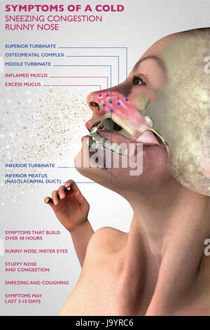 I sintomi di un raffreddore, anatomia umana, 3d sezione di un volto, ragazza con il freddo. Allergia ai pollini. Il rendering 3D Foto Stock