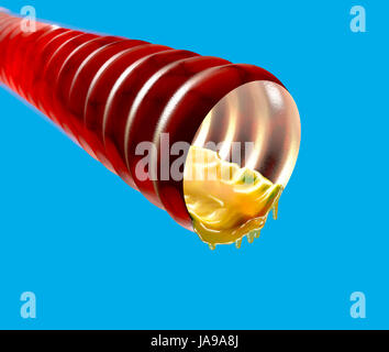 Trachea con il muco, catarro, 3d sezione. Condotto che serve per trasferire l'aria dall'esterno verso i polmoni. Il rendering 3D Foto Stock