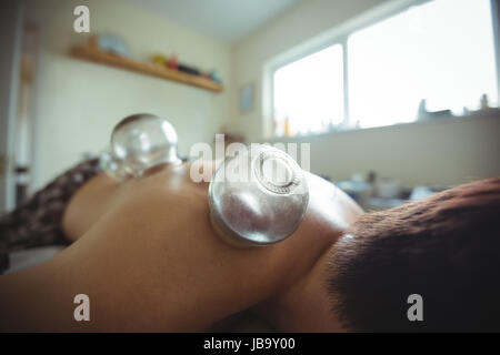 L'uomo riceve Terapia cupping in spa Foto Stock