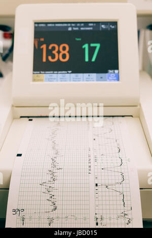 Monitoraggio fetale dispositivo in un ospedale grafico di visualizzazione di monitor fetali attività cardiaca. Foto Stock