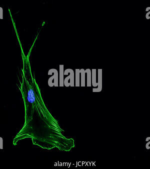 Immunofluorescenza imaging confocale di una singola misurazione invasiva di cellula di cancro al polmone con il citoscheletro in verde e nucleo in blu Foto Stock