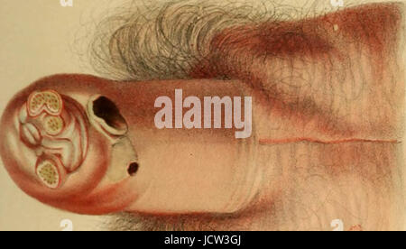 'A completare il lavoro pratico su la natura e il trattamento di malattie veneree e altre affezioni dell'apparato uro-organi del maschio e femmina .." (1848) Foto Stock