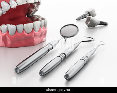 Professional dentista strumenti isolati su sfondo bianco. 3D'illustrazione. Foto Stock