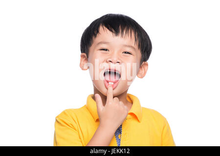 Perso il latte dente ragazzo asiatico, vista ravvicinata. Foto Stock