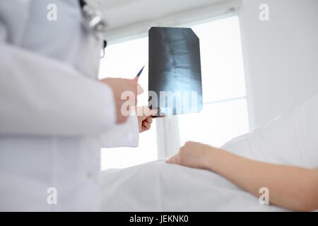 Medico donna esamina un X-ray immagine della colonna vertebrale accanto al paziente sdraiato sul letto in ospedale. Foto Stock