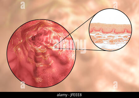 Esofago parete. Micrografia di luce di una sezione attraverso l'esofago umano che passa il cibo dalla bocca allo stomaco. L'esofago lumen (bianco, in alto) è rivestita da uno spesso strato di epitelio squamoso stratificato (rosso) che protegge il tessuto sottostante. Al di sotto di questo è uno strato di supporto di tessuto connettivo, la lamina propria, che contiene i vasi sanguigni ed è ricca di fibre di elastina. Foto Stock