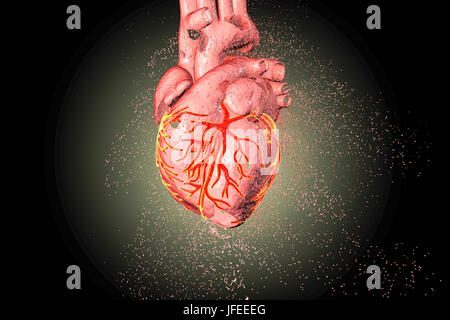 Cuore di distruzione. Concettuale illustrazione di computer che possono essere utilizzati per illustrare le malattie di cuore. Foto Stock