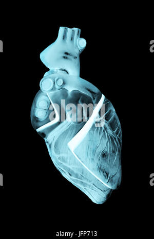 3D illustrazione la radiografia di un cuore umano Foto Stock