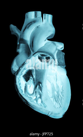 Negativo 3D illustrazione la radiografia di un cuore umano Foto Stock