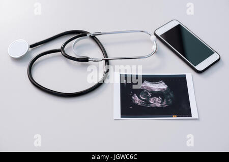 Stetoscopio medico con ultrasuoni risultati di investigazione e di smartphone sul piano portapaziente Foto Stock