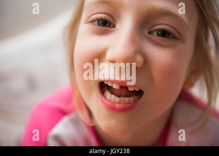 Ritratto di ragazza con dente mancante guardando la telecamera bocca aperta Foto Stock