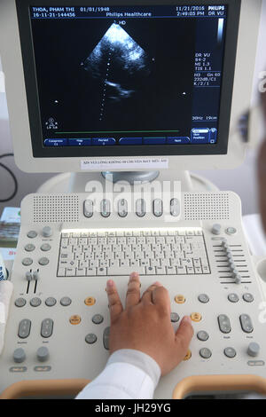 Duc Tam Heart Hospital. Ecocardiogramma Doppler. Ho Chi Minh City. Il Vietnam. Foto Stock