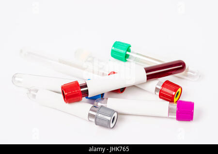 Vuoto tubi di sangue per la raccolta di campioni di sangue di utilizzare in laboratorio su sfondo bianco. Foto Stock