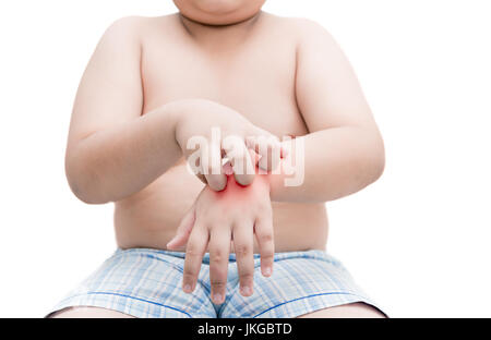 Obesi fat boy graffiare il prurito con mano. prurito isolati su sfondo bianco, del concetto di salute e medicina Foto Stock