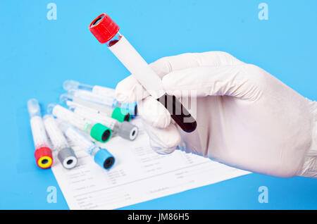 Mano che tiene il vuoto tubi di sangue per la raccolta di campioni di sangue in laboratorio. Foto Stock