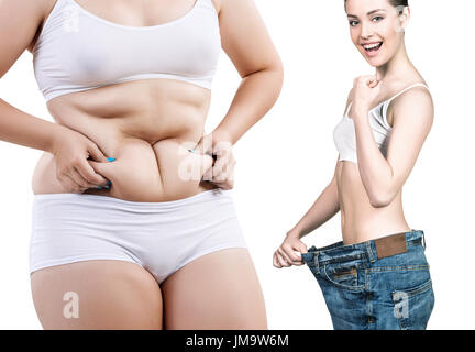 Collage di corpo femminile prima e dopo la perdita di peso su sfondo bianco Foto Stock