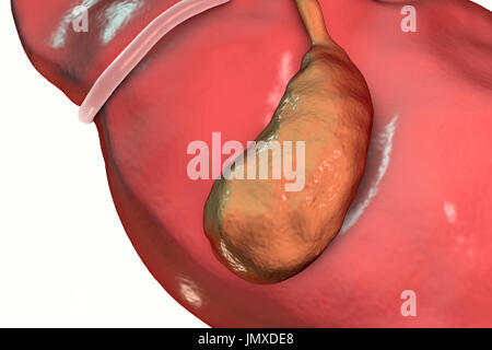 Colecisti sani, illustrazione del computer. Foto Stock