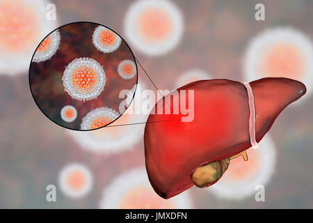 Fegato con epatite e vista ravvicinata di epatite C, virus di illustrazione. Foto Stock