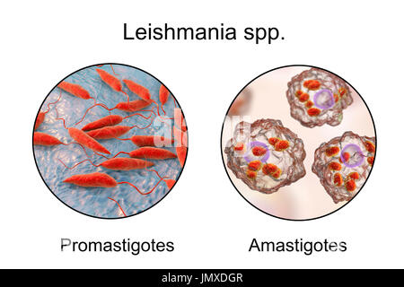 E Promastigotes amastigotes di parassiti Leishmania all'interno di macrofagi, illustrazione. Leishmania sp. causano la leishmaniosi, malattia tropicale trasmessa da punture di sabbia infetti-mosche. Questi sono i flagellato forma promastigote del parassita. Negli esseri umani il flagellato stadio promastigotes infetta i macrofagi e si trasforma in amastigote non-stadio flagellato. Ci sono due forme di leishmaniosi. Il primo, leishmaniosi cutanea, colpisce la pelle dando luogo ad un'ulcera al sito del morso. Questo principalmente guarisce naturalmente, sebbene la cicatrizzazione possono verificarsi. Il più grave, Foto Stock
