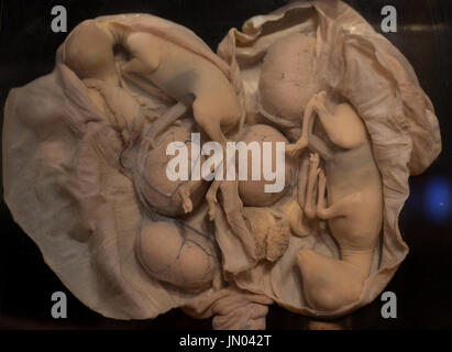 Embrioni di animali in utero in formaldeide utilizzati per l'istruzione e gli esperimenti Foto Stock