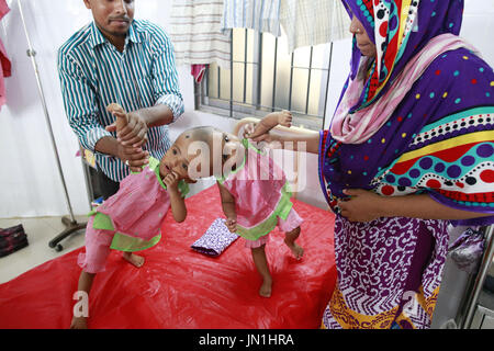 Dacca in Bangladesh. 29 Luglio, 2017. Taslima Khatun gioca con i suoi congiunti figlie gemelle Rabeya e Rokeya presso un ospedale a Dhaka, nel Bangladesh, 29 luglio 2017. Credito: Suvra Kanti Das/ZUMA filo/Alamy Live News Foto Stock