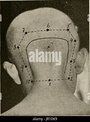 "Locale e anestesia regionale; con capitoli su spinale, epidurale, paravertebral e parasacral analgesia e altre applicazioni locali e regionali di anestesia per la chirurgia dell'occhio, orecchio, naso e gola, e alla pratica dentistica' Foto Stock