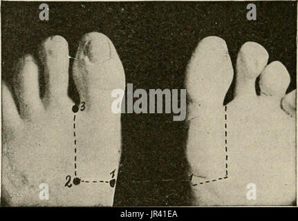 "Locale e anestesia regionale; con capitoli su spinale, epidurale, paravertebral e parasacral analgesia e altre applicazioni locali e regionali di anestesia per la chirurgia dell'occhio, orecchio, naso e gola, e alla pratica dentistica' Foto Stock