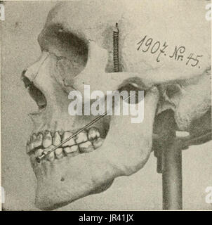 "Locale e anestesia regionale; con capitoli su spinale, epidurale, paravertebral e parasacral analgesia e altre applicazioni locali e regionali di anestesia per la chirurgia dell'occhio, orecchio, naso e gola, e alla pratica dentistica' Foto Stock