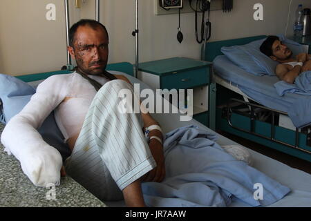 Soldato afgano Sabiuallah giacente a letto nel paese più grande ospedale militare a Kabul, la capitale dell'Afghanistan, 24 luglio 2017. Sabiullah è stato ferito il 20 luglio nella provincia centrale di Maidan Wardak quando un IED esploso davanti a lui durante una pattuglia. Shrapnel lo ha colpito nel braccio e in faccia. Foto: Christine-Felice Röhrs/dpa Foto Stock