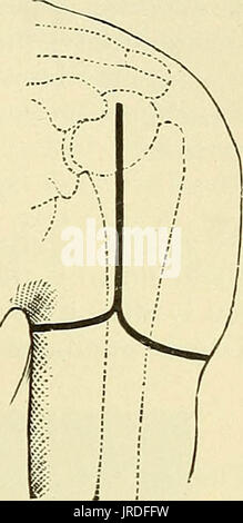 " Un manuale per la moderna chirurgia : una esposizione delle dottrine accettato e approvato le procedure operative del tempo presente, per l'uso di studenti e professionisti' (1899) Foto Stock