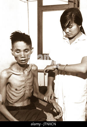 Gli effetti di un solo mese trascorso in un Viet Cong campo di prigionia visualizza il 23-anno-vecchio Le Van a chi aveva difettato da forze comuniste e unite al lato del Governo, è stato ripreso dai Viet Cong e deliberatamente di fame. Ca. 1966. (USIA) DATA ESATTA SHOT NARA SCONOSCIUTO FILE #: 306-PSC-66-3211 guerra & conflitto prenota #: 413 Foto Stock