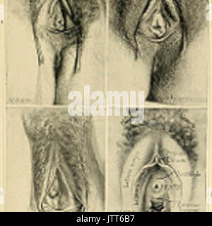 'Un Americano di libro di testo di ostetricia. Per professionisti e studenti" (1897) Foto Stock