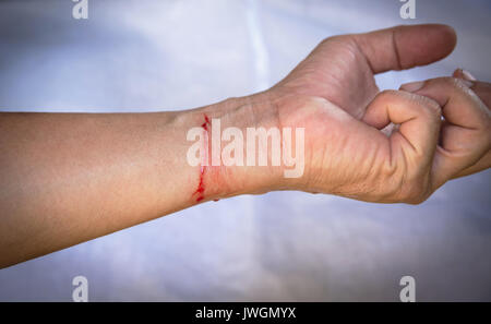 Mano piena di sangue e polso taglio sul tessuto bianco rappresentano sentendosi ferita. rapporto cattivo concetto. Foto Stock