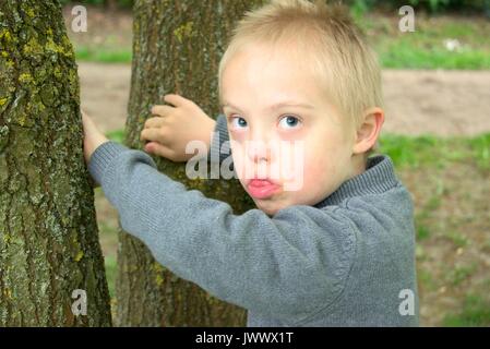 Riflessivo ragazzo con la sindrome di down che abbracci gli alberi. Foto Stock