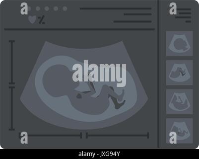 Silhouette di colore di ultrasuoni di monitoraggio del bambino nel dispositivo Illustrazione Vettoriale
