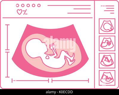 Silhouette di rosa di ultrasuoni di monitoraggio del bambino nel dispositivo Illustrazione Vettoriale